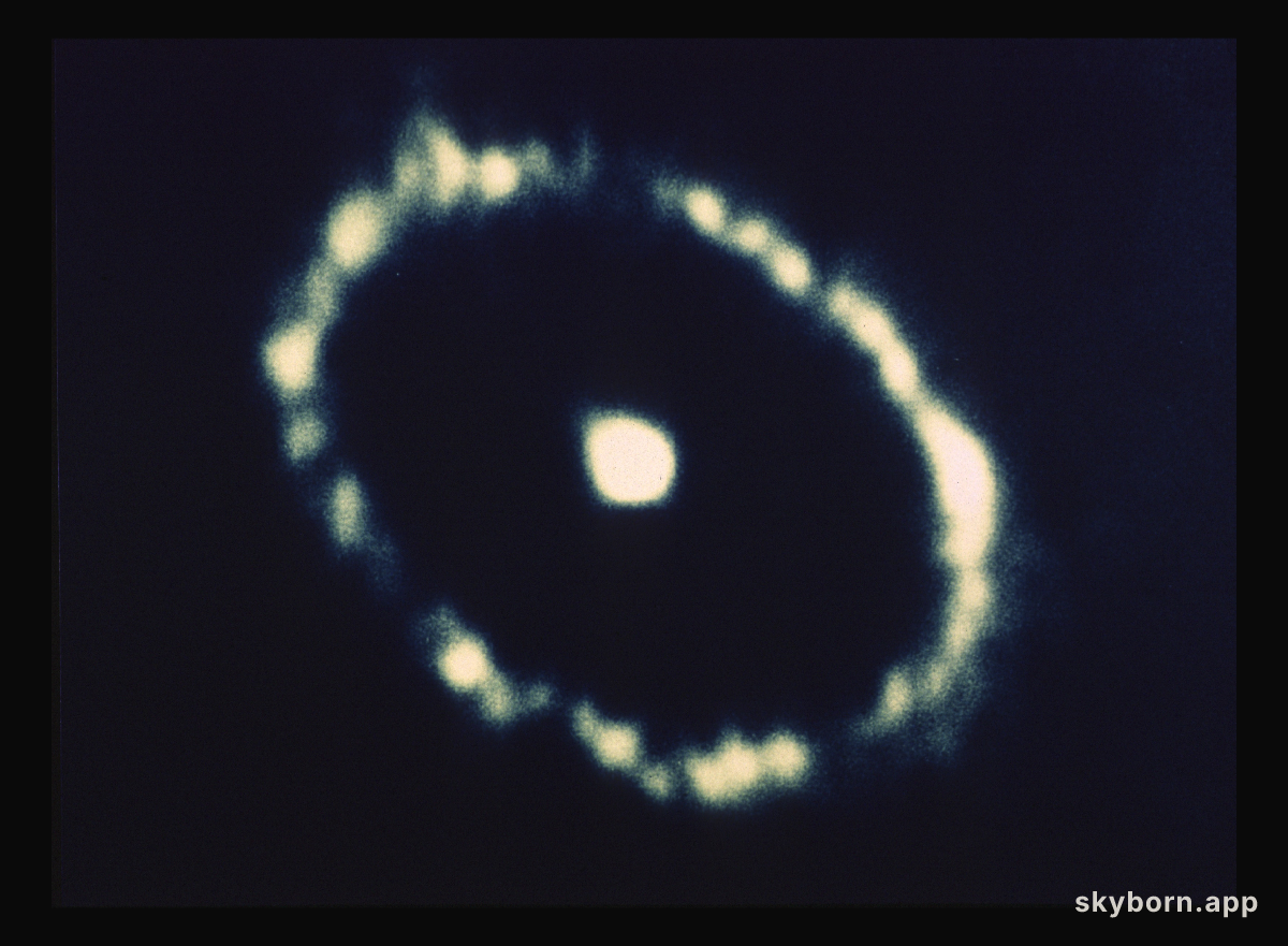 SN1987A