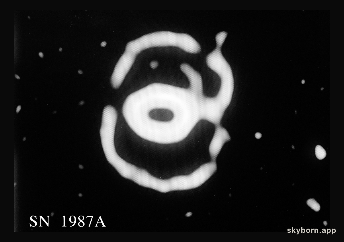 Changes in the ring nebula around SN 1987A