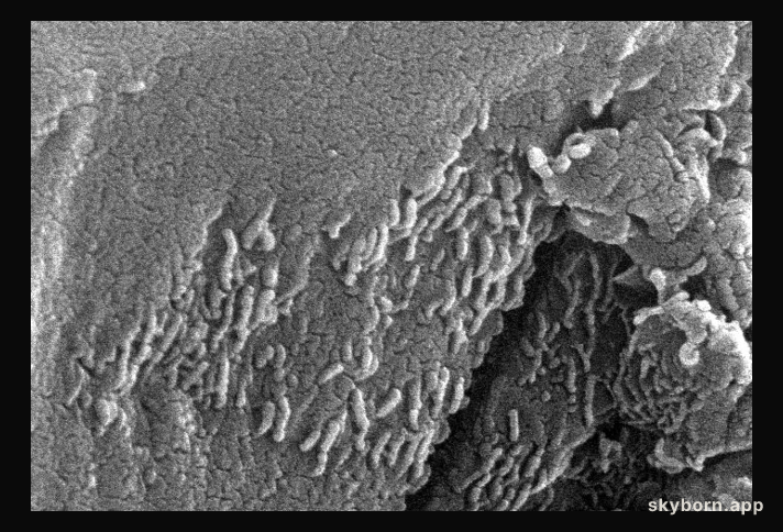 Early Microscopic Life on Mars?
