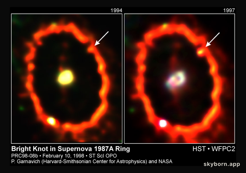 Shocked by Supernova 1987a