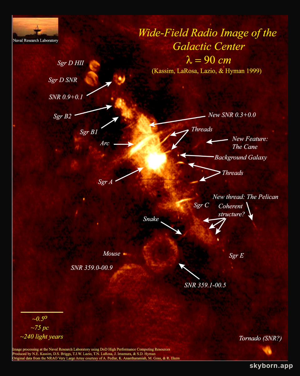 The Galactic Center - A Radio Mystery