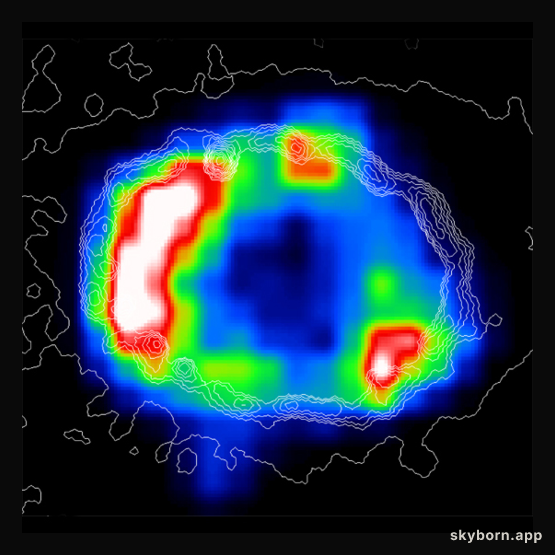 X-Ray Ring Around SN1987A