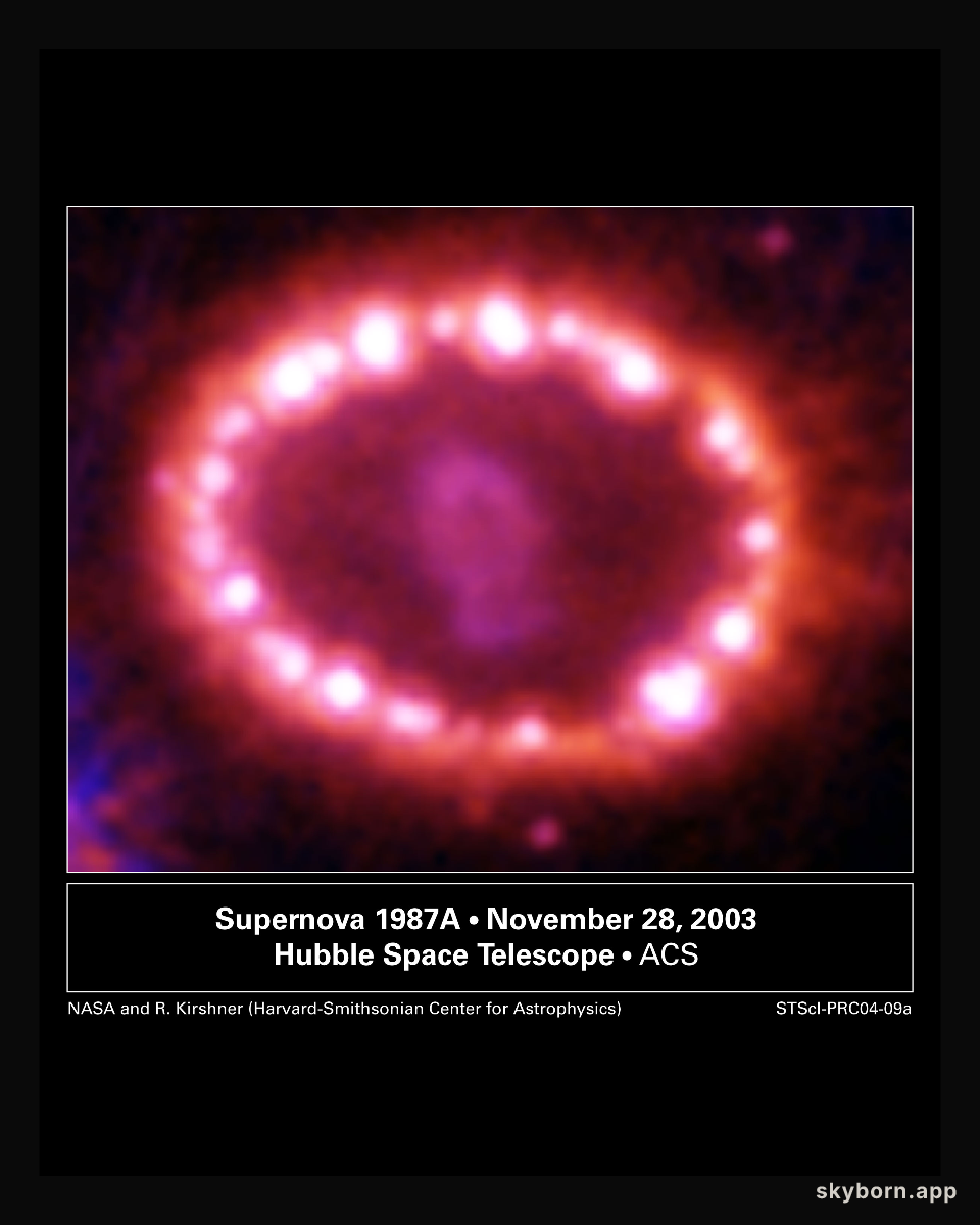 SN1987A's Cosmic Pearls