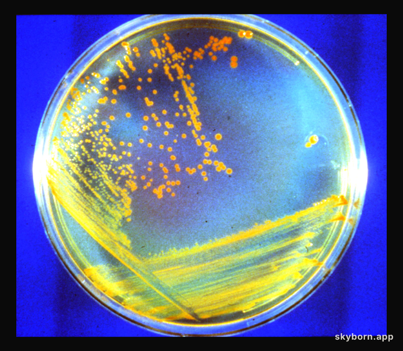 D. rad Bacteria: Candidate Astronauts