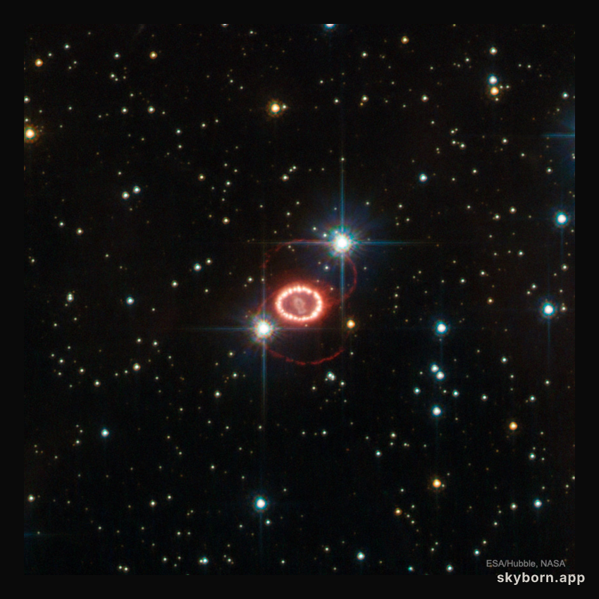 The Mysterious Rings of Supernova 1987A