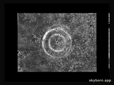 The Expanding Echoes of Supernova 1987A