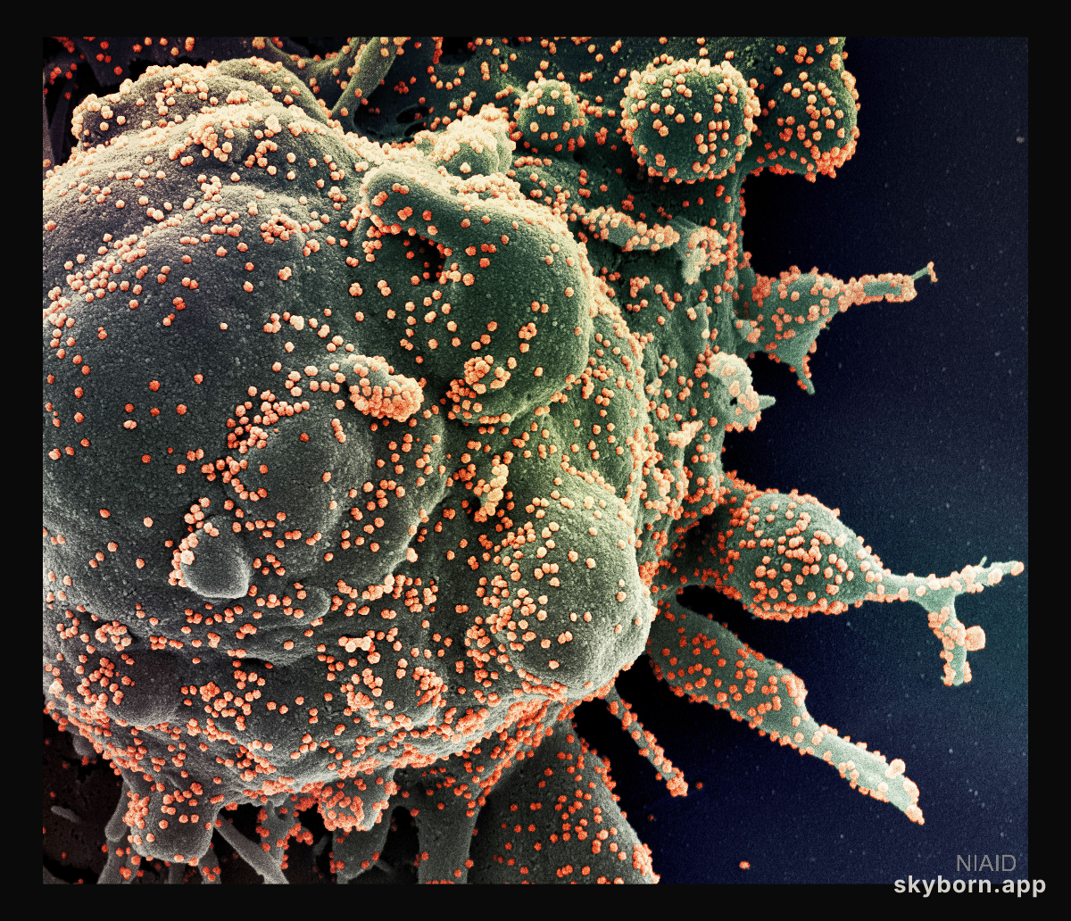 Novel Coronavirus Attacks Humanity