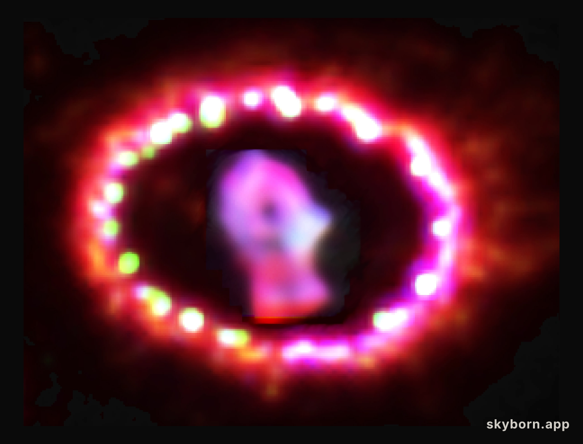 Image of Supernova 1987A