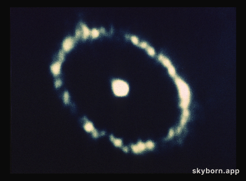 SN1987A