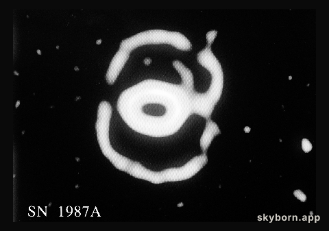 Changes in the ring nebula around SN 1987A